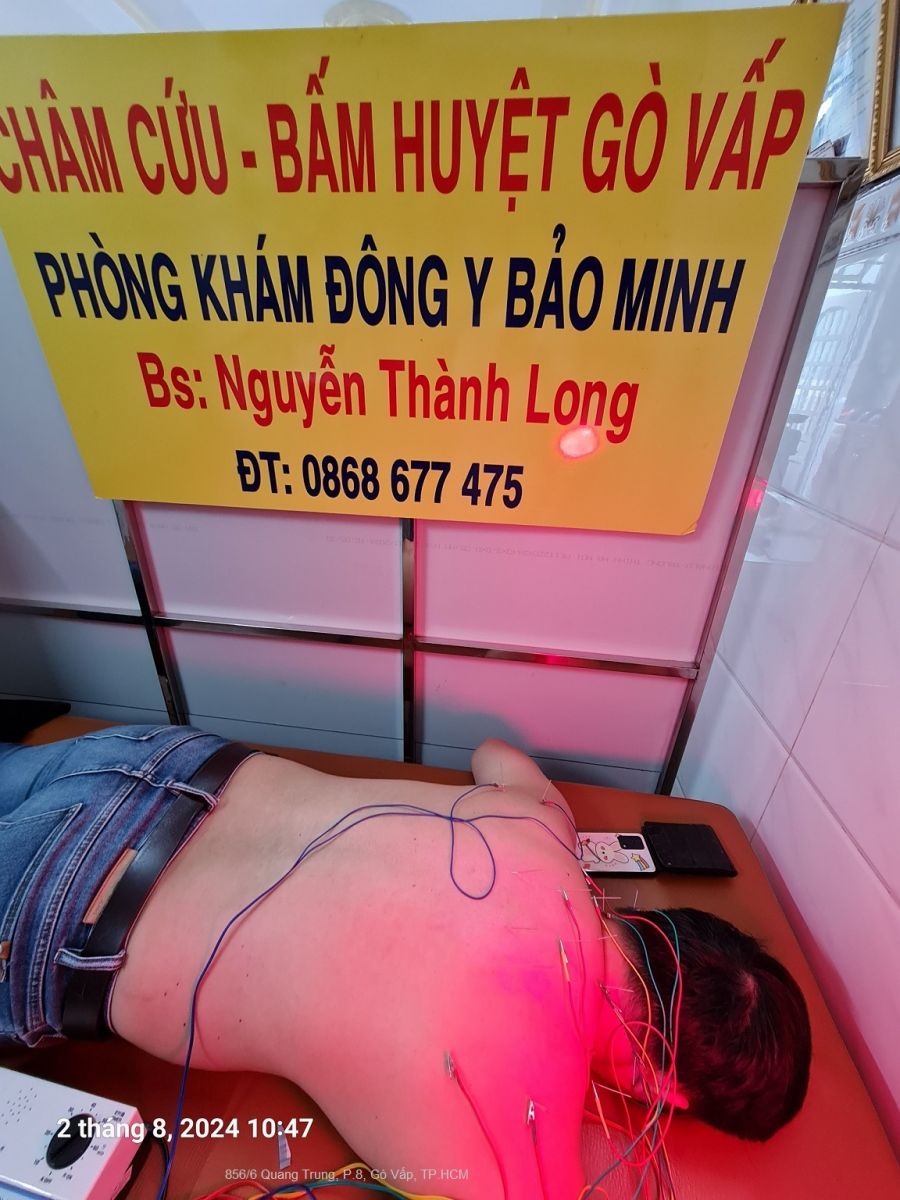 Cham-cuu-bam-huyet-go-vap